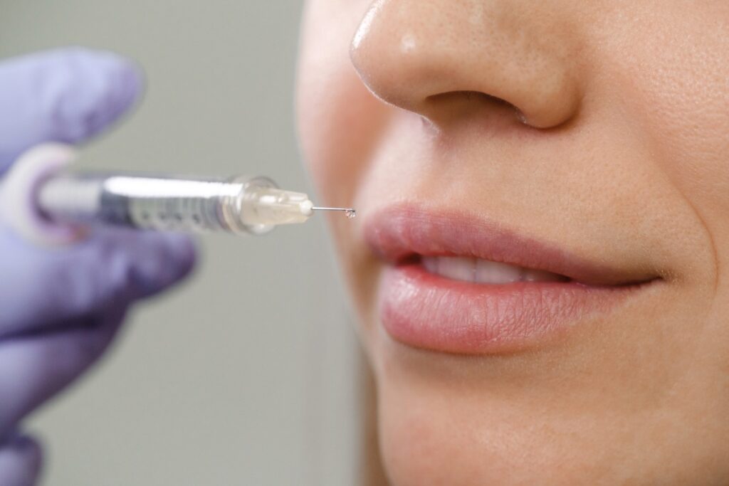 Une injection d'acide hyaluronique sur le visage d'une femme