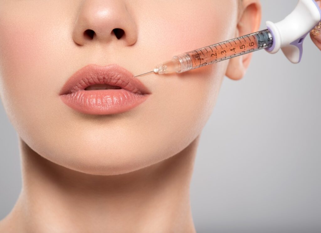 Acide hyaluronique injectée sur le visage d'une femme