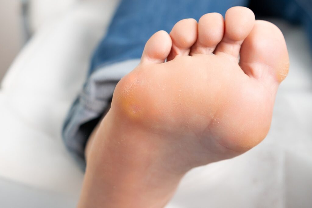 Une personne montrant son pied qui vibre
