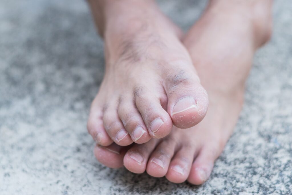 Pieds avec des ongles courts